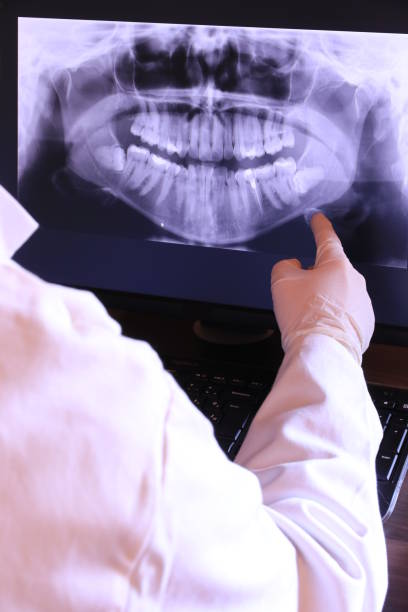 Best Emergency Treatment for Dental Infections or Abscesses in Harbor Isle, NY